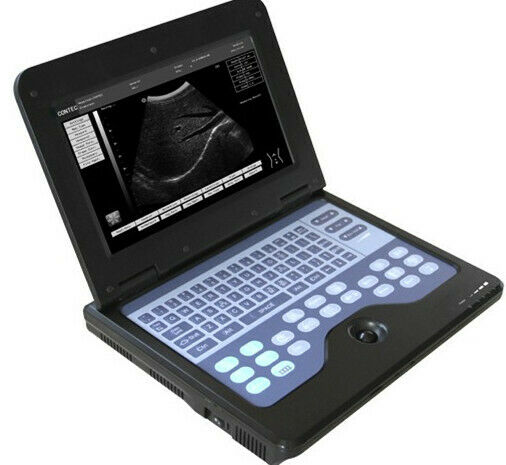 Digital Portable Ultrasound Machine Laptop Scanner with Convex Probe,US shipping 6945040100362 DIAGNOSTIC ULTRASOUND MACHINES FOR SALE