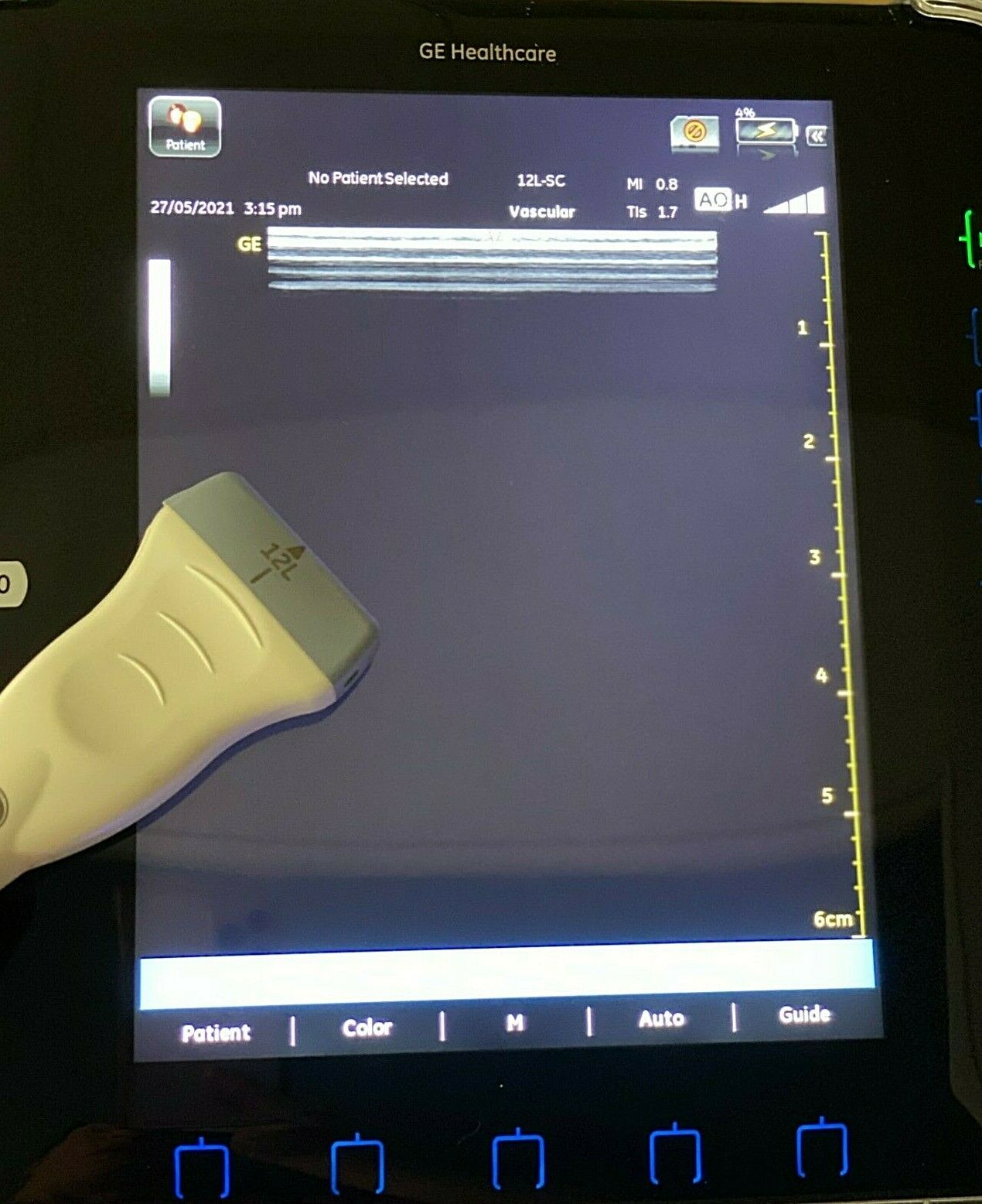 GE Venue 40 Ultrasound with Docking Station 12L-SC Probes DIAGNOSTIC ULTRASOUND MACHINES FOR SALE