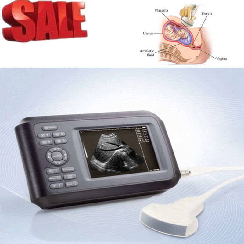 HandScan 5.5''Color Digital Ultrasound Scanner System+Convex Probe+Gift Oximeter DIAGNOSTIC ULTRASOUND MACHINES FOR SALE