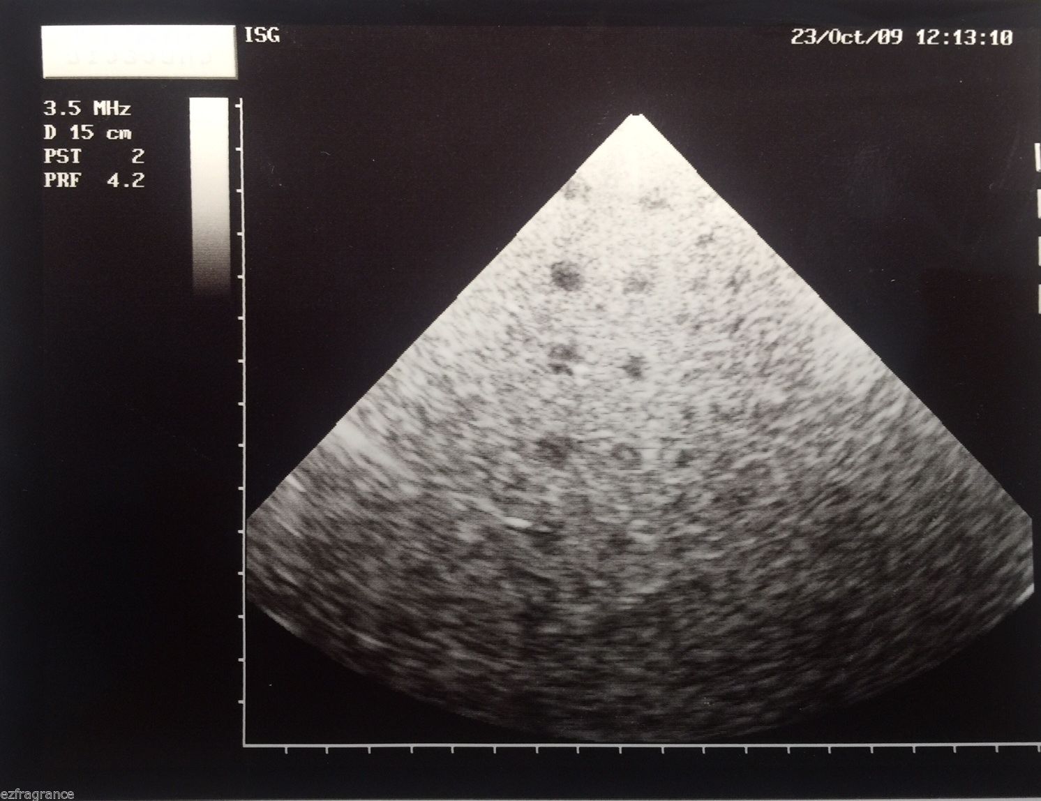 Esaote PA220E Phased Array Ultrasound Probe for Megas Caris Plus Technos USED DIAGNOSTIC ULTRASOUND MACHINES FOR SALE