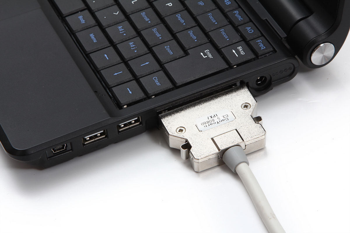 Portable Laptop Machine Digital Ultrasound Scanner 3.5MHz Probes 5.0MHz Probes DIAGNOSTIC ULTRASOUND MACHINES FOR SALE