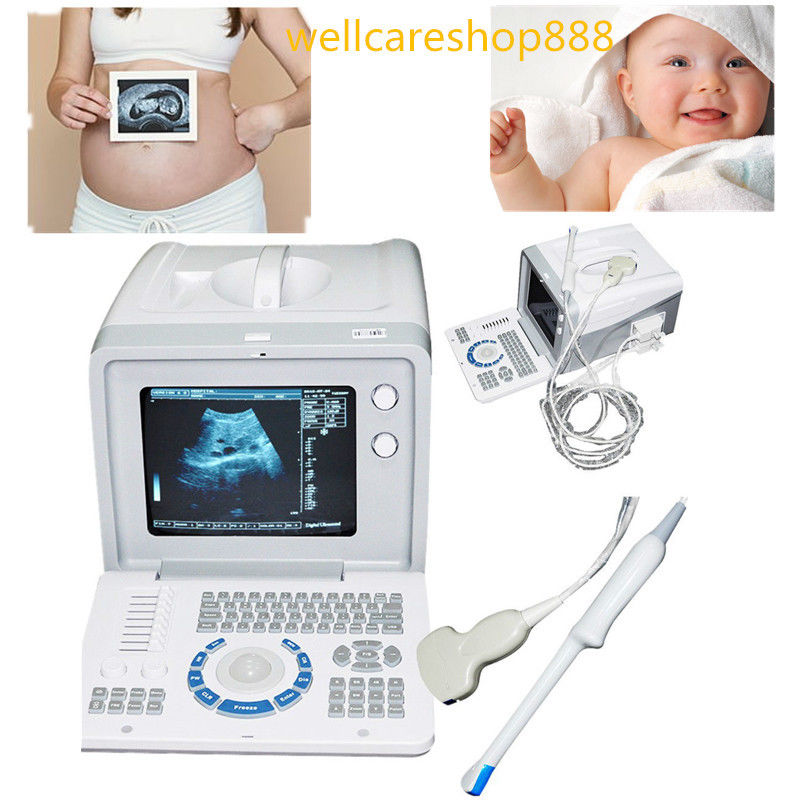 Portable digital Ultrasound Scanner Machine 3.5 convex &7.5 Transvaginal Probe DIAGNOSTIC ULTRASOUND MACHINES FOR SALE