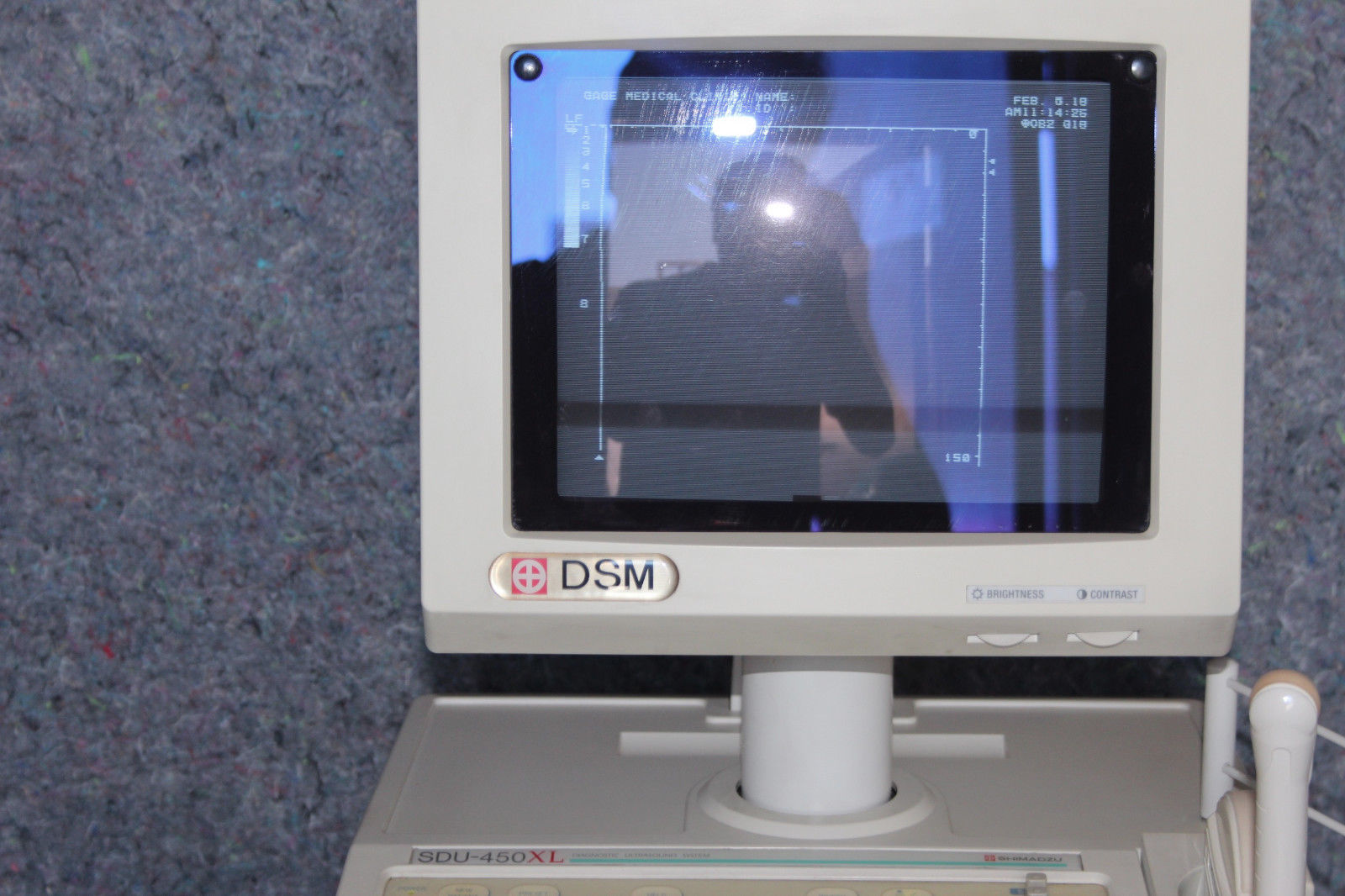 Shimadzu Diagnostic Ultrasound system SDU-450XL w/ two probes DIAGNOSTIC ULTRASOUND MACHINES FOR SALE