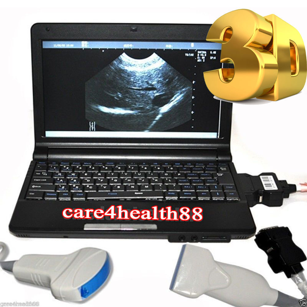 Color Full Digital Laptop 3D Ultrasound Scanner+Convex/Abdominal+Linear Probe CE DIAGNOSTIC ULTRASOUND MACHINES FOR SALE