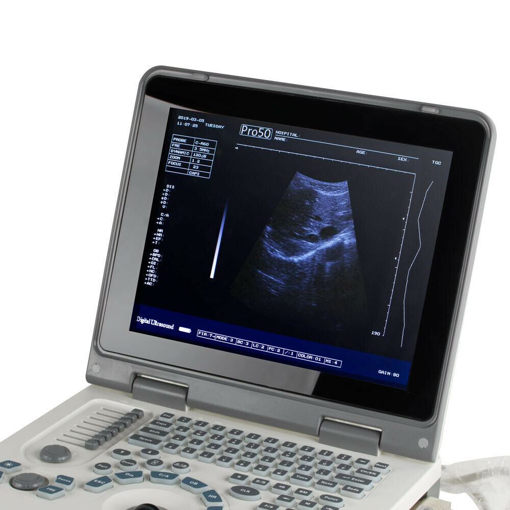 Portable Laptop Digital Ultrasound Scanner Machine with 3.5MHz Convex Probe+3D DIAGNOSTIC ULTRASOUND MACHINES FOR SALE