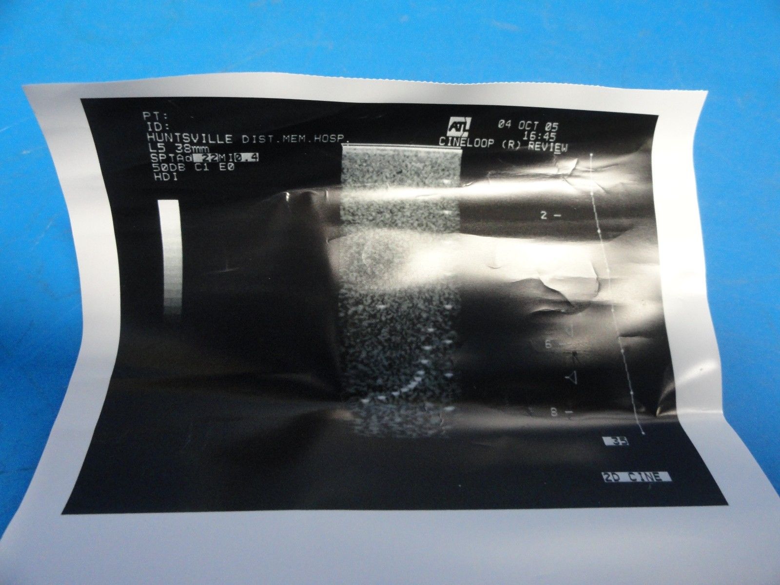 ATL L5 38MM (5.0LA) P/N 4000-0259-02D Linear Array Probe for UM9 HDI (8927) DIAGNOSTIC ULTRASOUND MACHINES FOR SALE