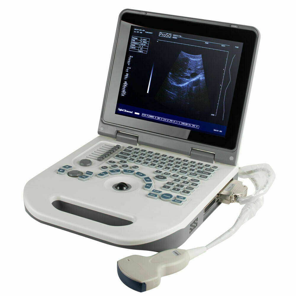 Portable Digital Ultrasound Scanner Ultrasonic MachineDisgnos Convex Probe 3D CE DIAGNOSTIC ULTRASOUND MACHINES FOR SALE