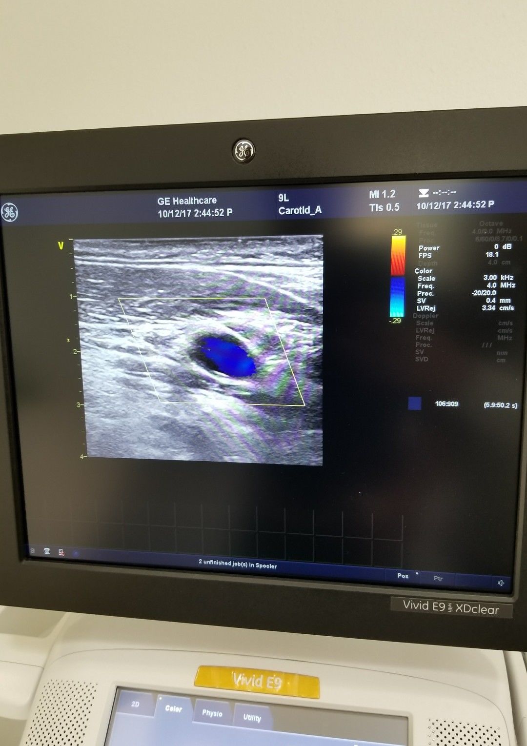 GE 9L-D Ultrasound Probe / Transducer DIAGNOSTIC ULTRASOUND MACHINES FOR SALE