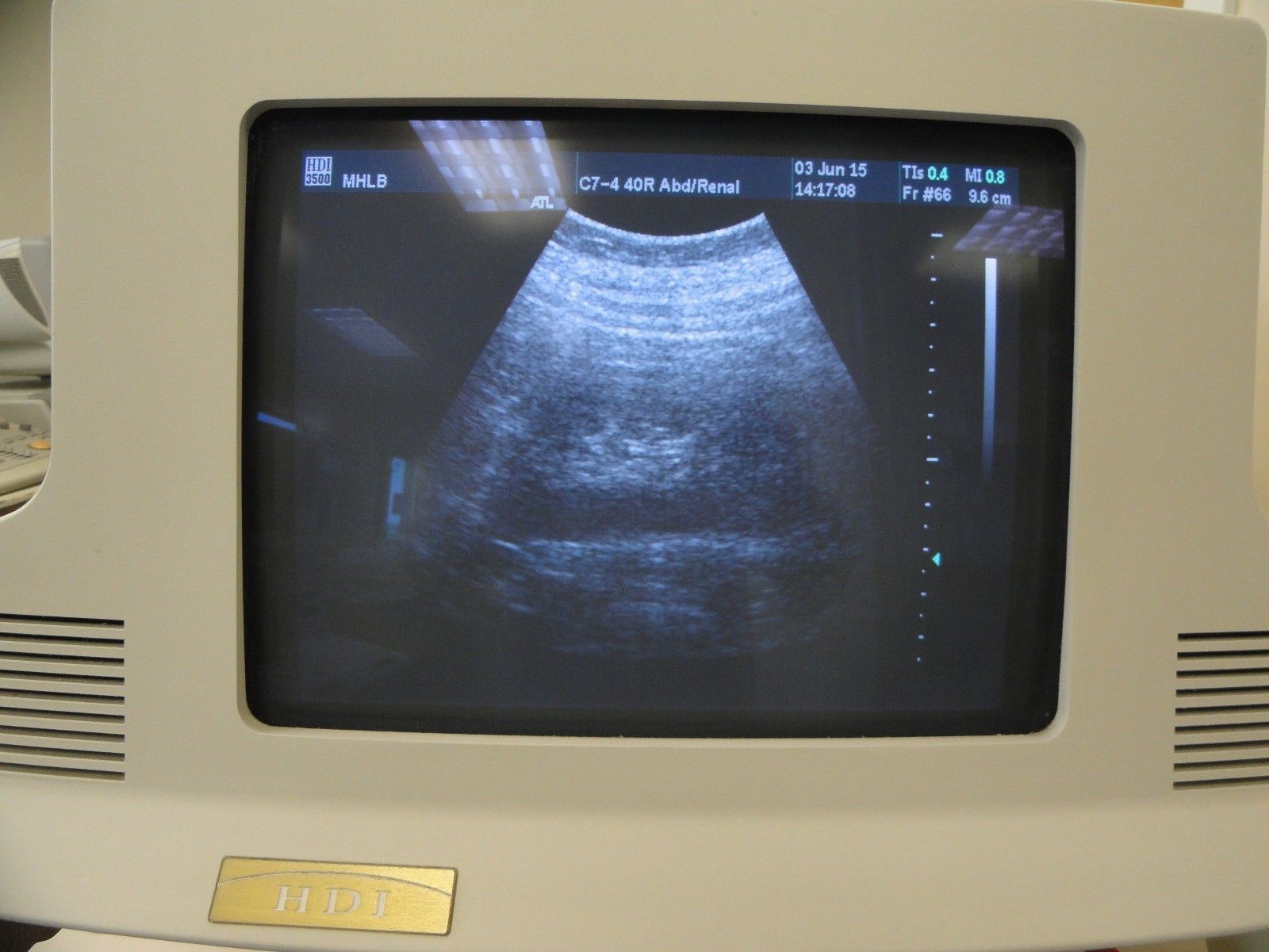 ATL C7-4 40R Curved Array Convex Abdominal Probe for ATL HDI Series (8938 ) DIAGNOSTIC ULTRASOUND MACHINES FOR SALE