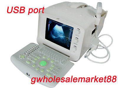 Portable ultrasound bladder scanner system Convex Transvaginal probe 3D Software DIAGNOSTIC ULTRASOUND MACHINES FOR SALE