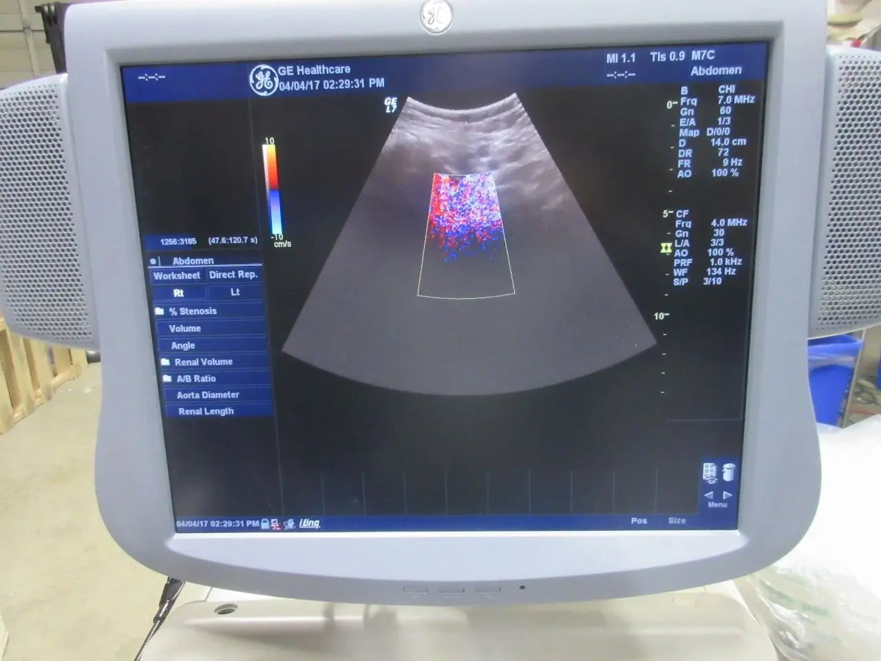 GE Logiq 7 ultrasound LCD with M12L linear, M7C convex and E8C endovag. DIAGNOSTIC ULTRASOUND MACHINES FOR SALE