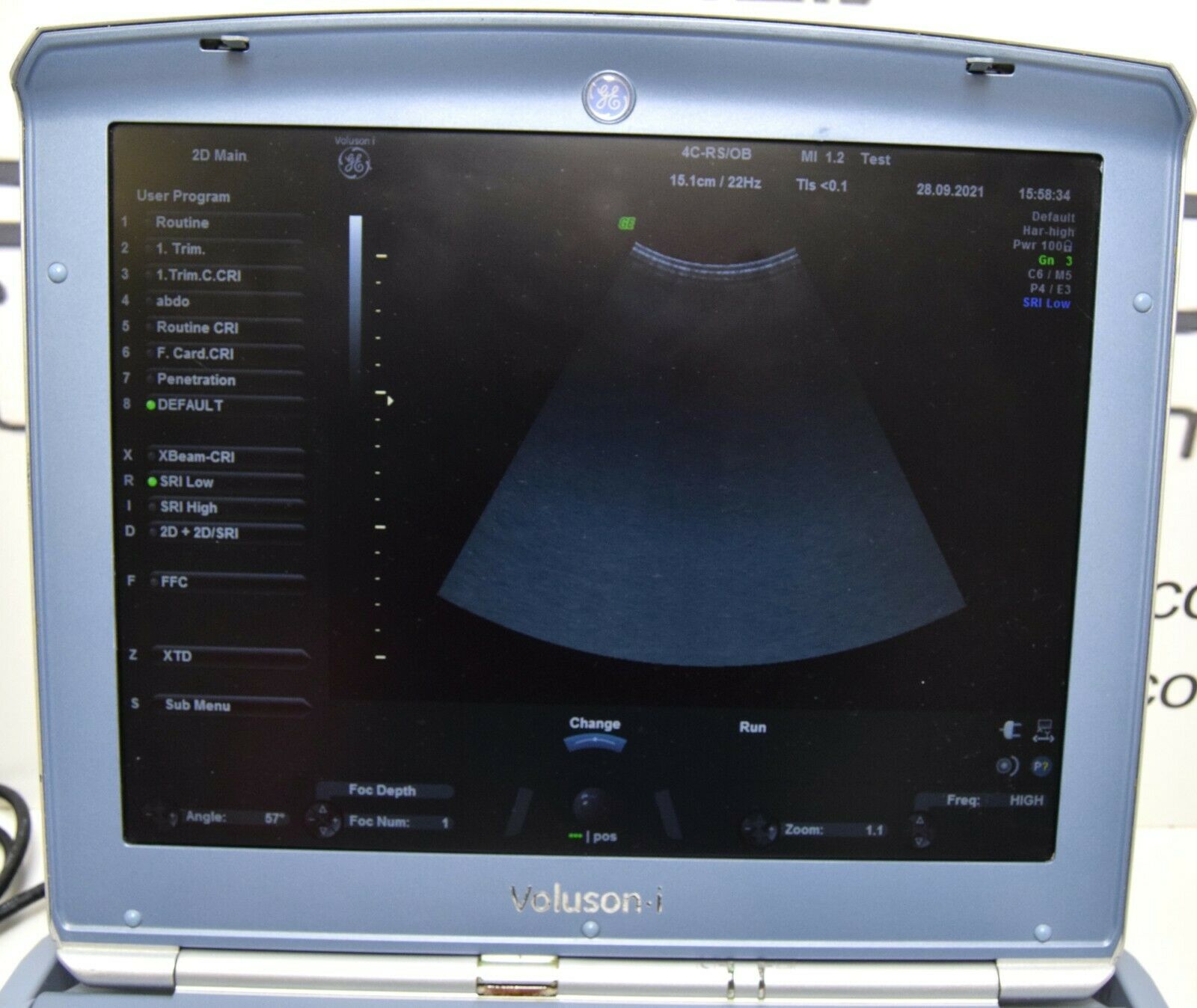 GE Voluson I BT14 portable ultrasound with 3 probes (year of manufacture 2016) DIAGNOSTIC ULTRASOUND MACHINES FOR SALE