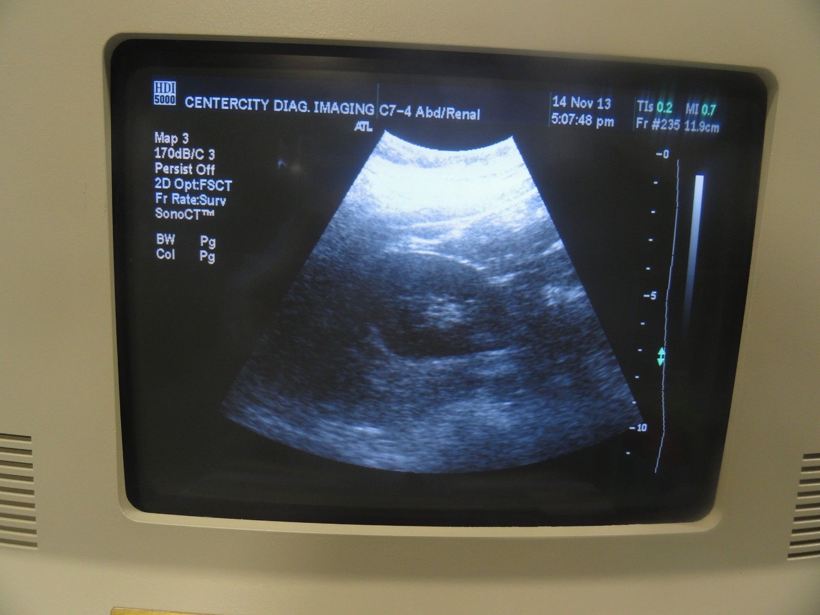 ATL C7-4 40R Curved Array Convex Ultrasound Probe for ATL HDI Series (5966 ) DIAGNOSTIC ULTRASOUND MACHINES FOR SALE