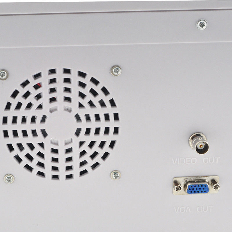 Portable LCD Digital Ultrasound Scanner with 7.5 mhz Linear Probe + 3D Software DIAGNOSTIC ULTRASOUND MACHINES FOR SALE