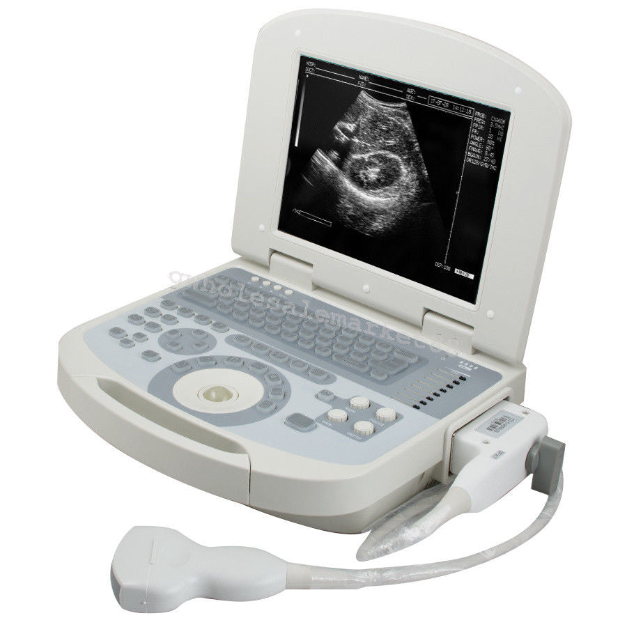 Laptop Ultrasound Machine Scanner Convex Probe 3D Software Clear Medical Clinic 190891045898 DIAGNOSTIC ULTRASOUND MACHINES FOR SALE