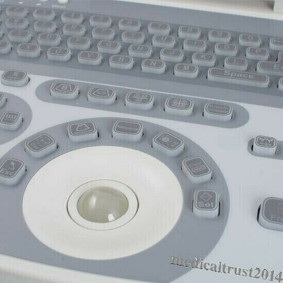 Portable Human Digital Laptop Ultrasound Scanner Machine System Convex Probe 3D DIAGNOSTIC ULTRASOUND MACHINES FOR SALE