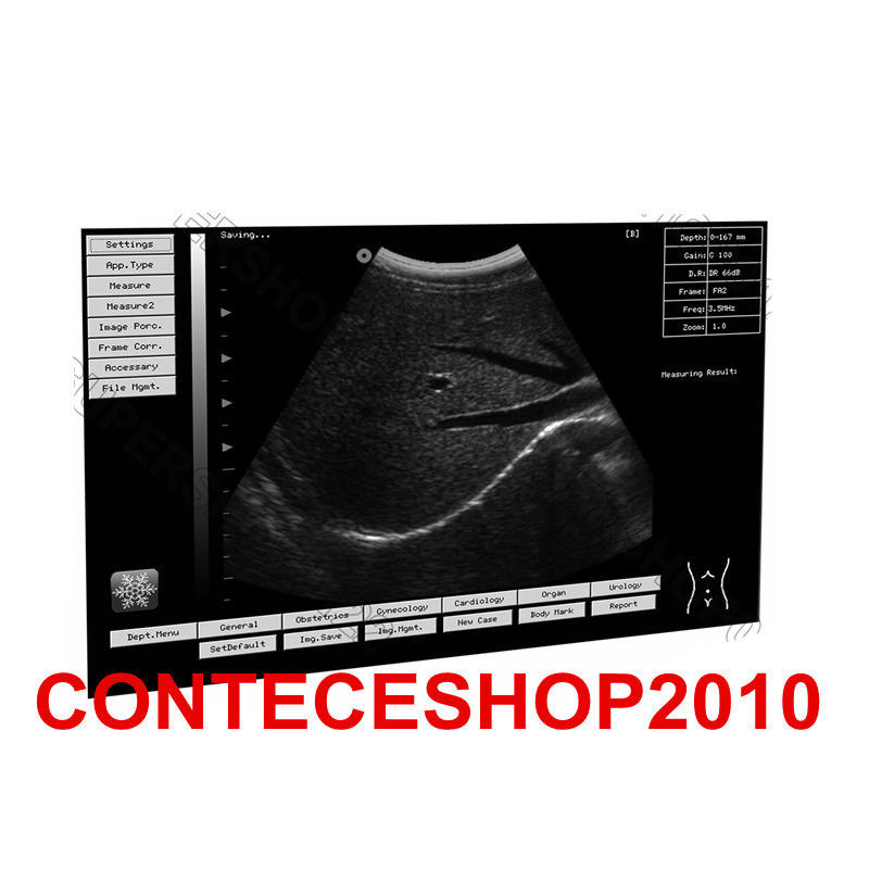 Portable Laptop Machine Digital Ultrasound Scanner, probe, human/vet, USA Fedex DIAGNOSTIC ULTRASOUND MACHINES FOR SALE