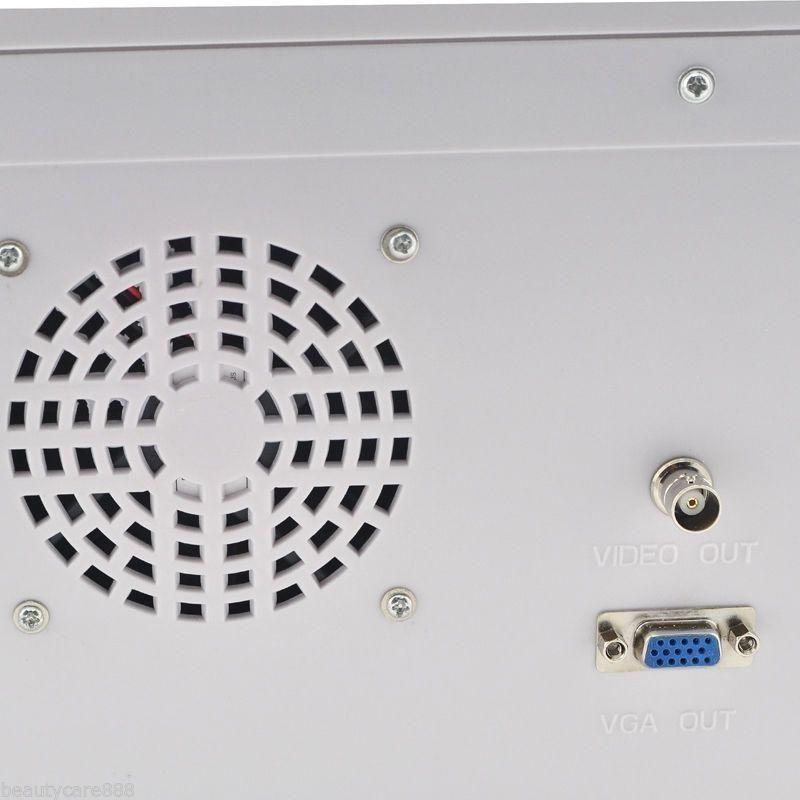 Portable Digital Ultrasound machine Scanner+3.5Mhz convex Probe+*3Dworkstation** 190891888099 DIAGNOSTIC ULTRASOUND MACHINES FOR SALE