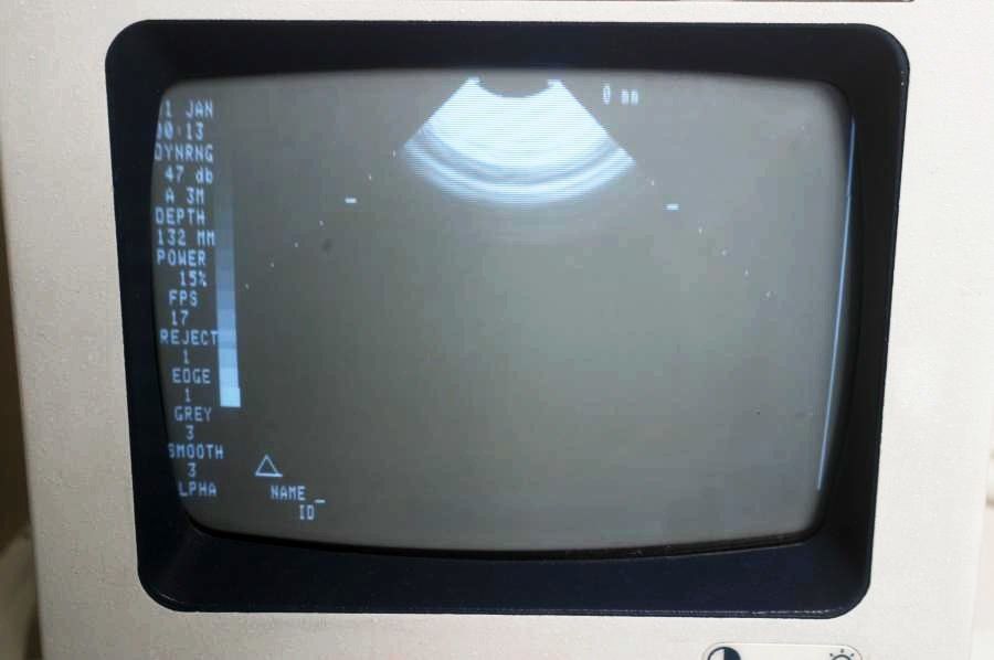 screen monitor overhead