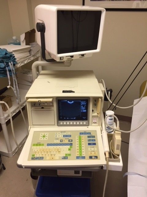 Shimadzu SDL-310 ultrasound machine with thermal printer and monitor DIAGNOSTIC ULTRASOUND MACHINES FOR SALE