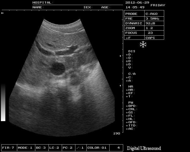 Portable Digtial Ultrasound Scanner Machine Linear Probe 3D Module Fast Sale 190891862518 DIAGNOSTIC ULTRASOUND MACHINES FOR SALE