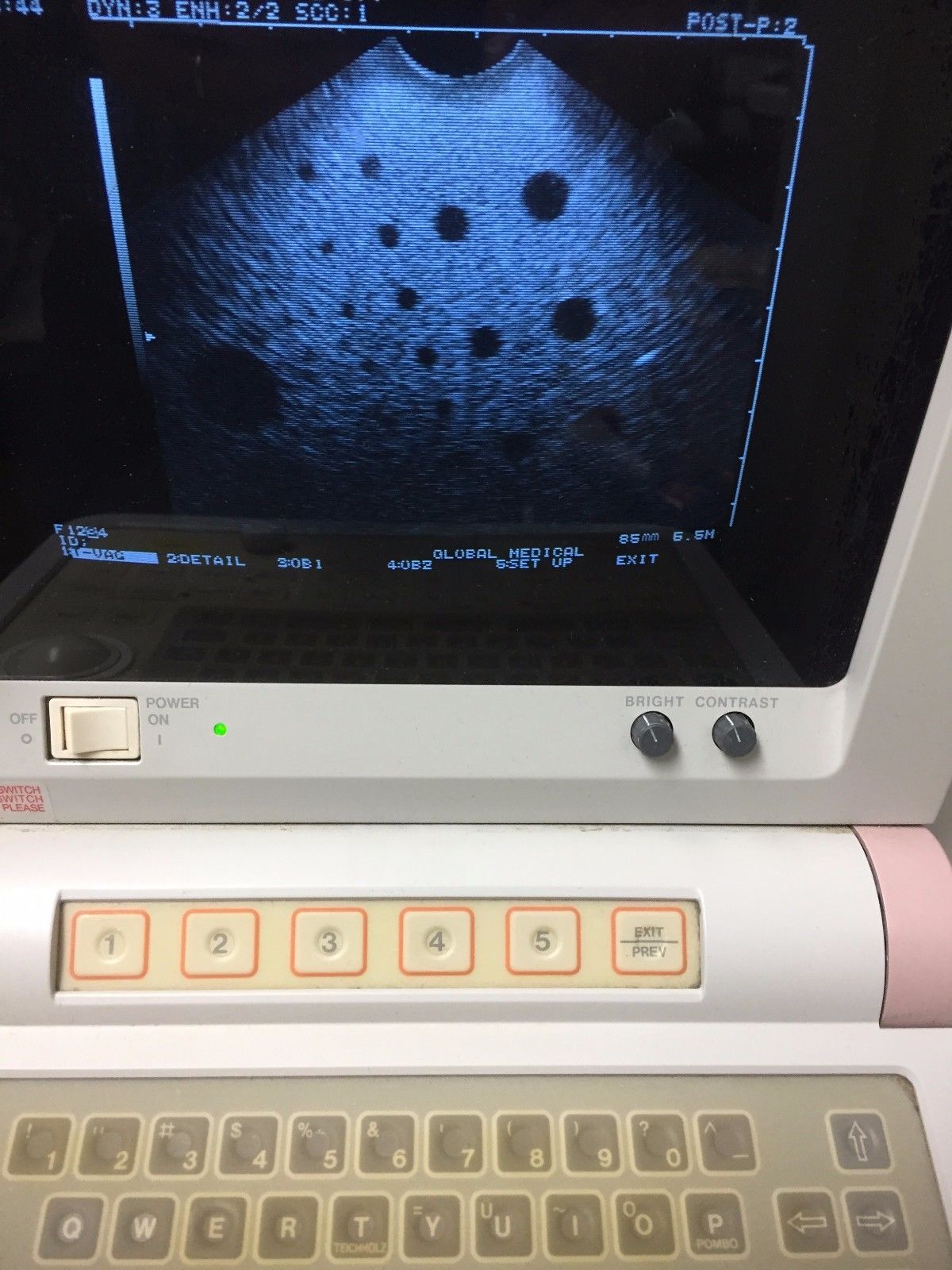 Hitachi EUP-V33 Intercavity Ultrasound Probe DIAGNOSTIC ULTRASOUND MACHINES FOR SALE