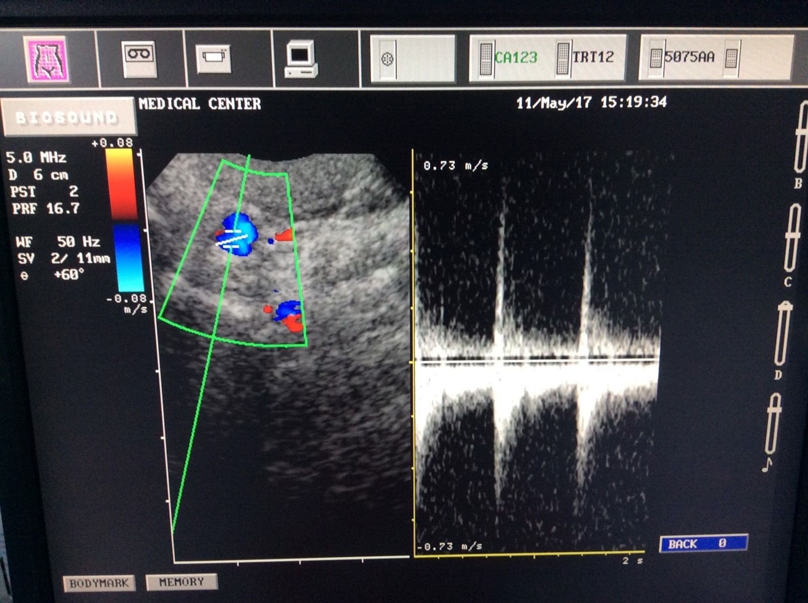 Esaote Biosound, MyLab ultrasound CA123 micro convex probe DIAGNOSTIC ULTRASOUND MACHINES FOR SALE