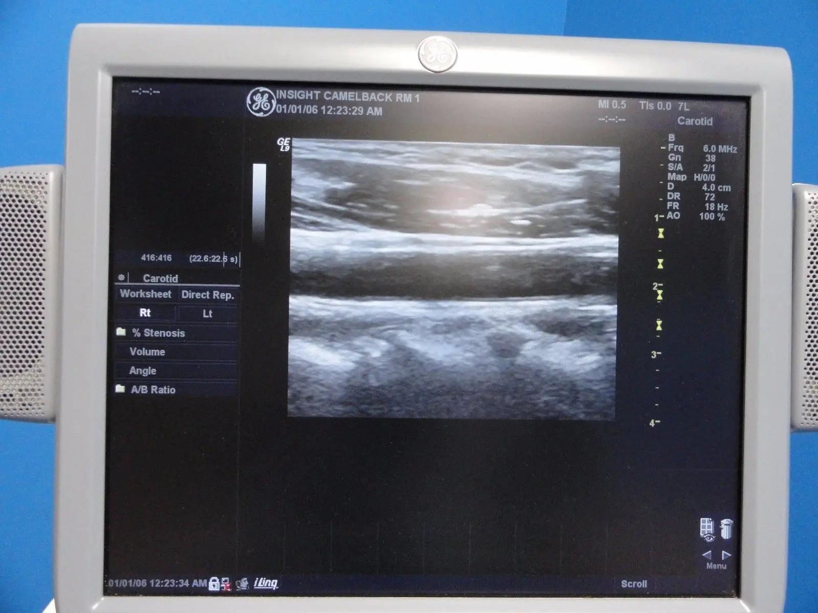 GE 7L / 2302648 Linear Array Ultrasound Probe for Logiq & Vivid Series~13787 DIAGNOSTIC ULTRASOUND MACHINES FOR SALE