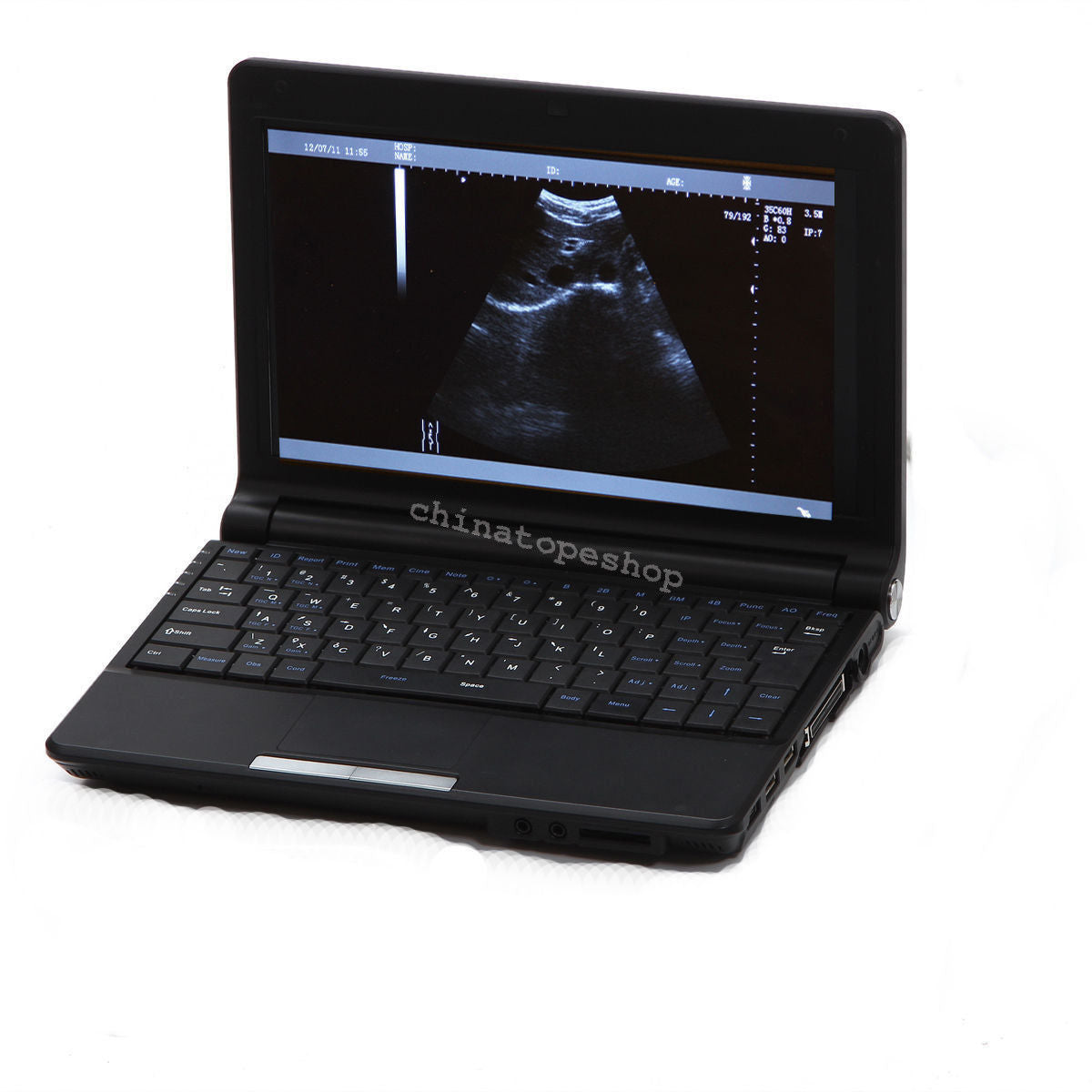 Laptop Machine Ultrasound scanner Transvaginal probe 3D Worksation + Case 190891297143 DIAGNOSTIC ULTRASOUND MACHINES FOR SALE