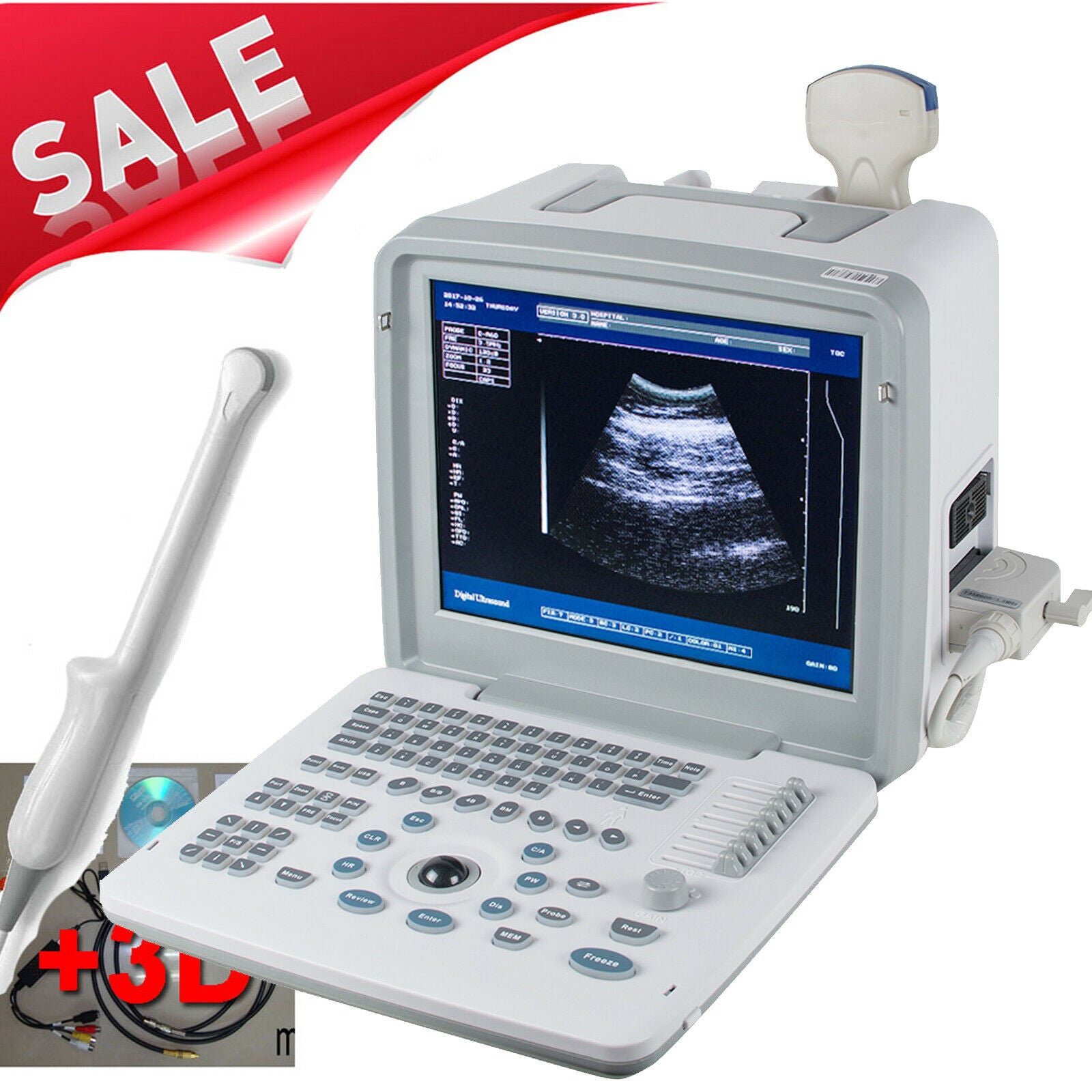 Portable LCD Digital Ultrasound Scanner Machine Convex+Transvaginal 2 Probe DHL DIAGNOSTIC ULTRASOUND MACHINES FOR SALE