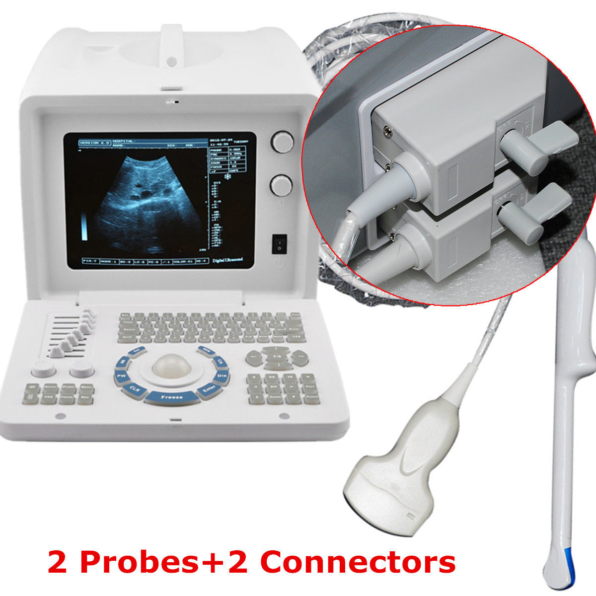 Digital B Ultrasound Scanner Machine Convex/Curved+Transvaginal Probe Sale 3D DIAGNOSTIC ULTRASOUND MACHINES FOR SALE