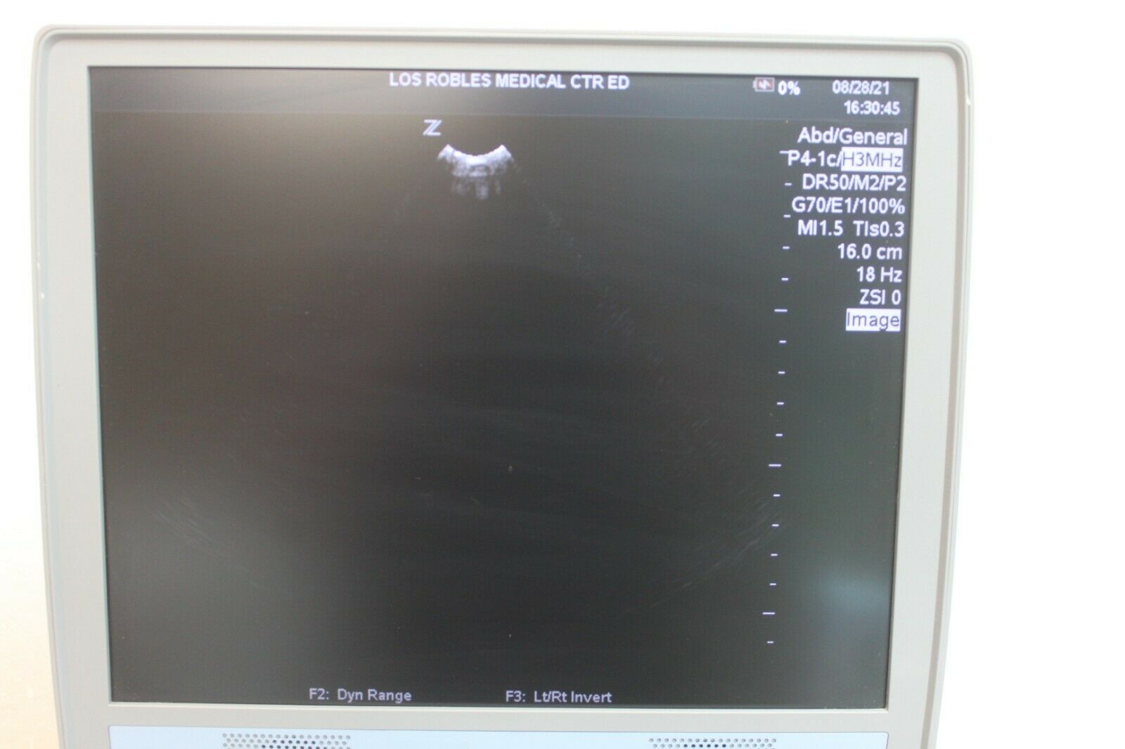 Zonare Z One Ultra Ultrasound with 3 Transducers DIAGNOSTIC ULTRASOUND MACHINES FOR SALE