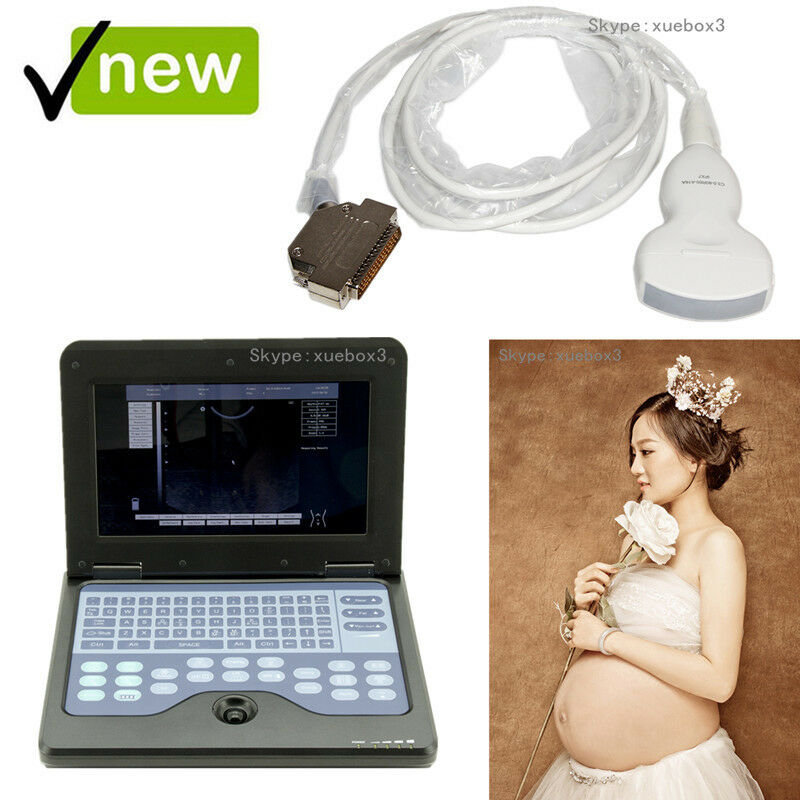 Portable laptop Digital Ultrasound scanner,pregnancy,Abdominal probe US seller 6945040100362 DIAGNOSTIC ULTRASOUND MACHINES FOR SALE