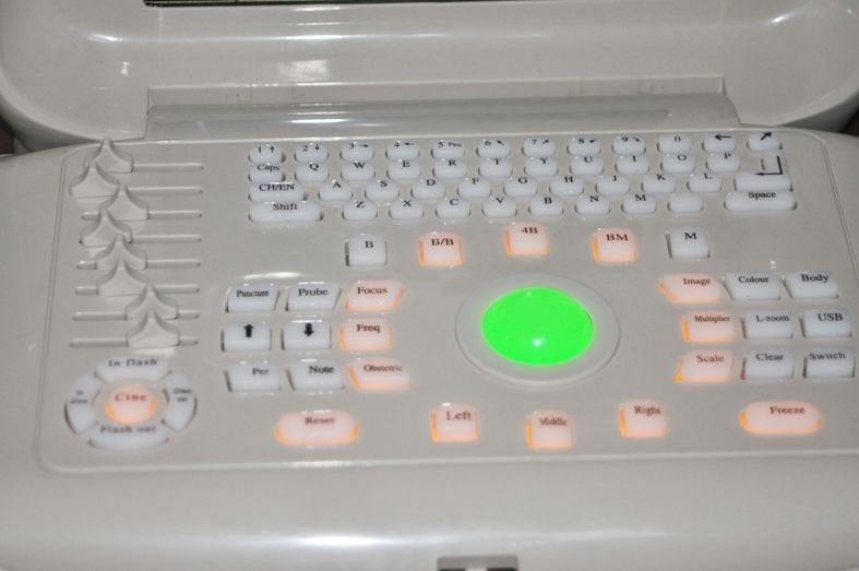 Digital Ultrasound Scanner B Ultrasound machine Convex +Linear 2 Probes 3D Sale DIAGNOSTIC ULTRASOUND MACHINES FOR SALE