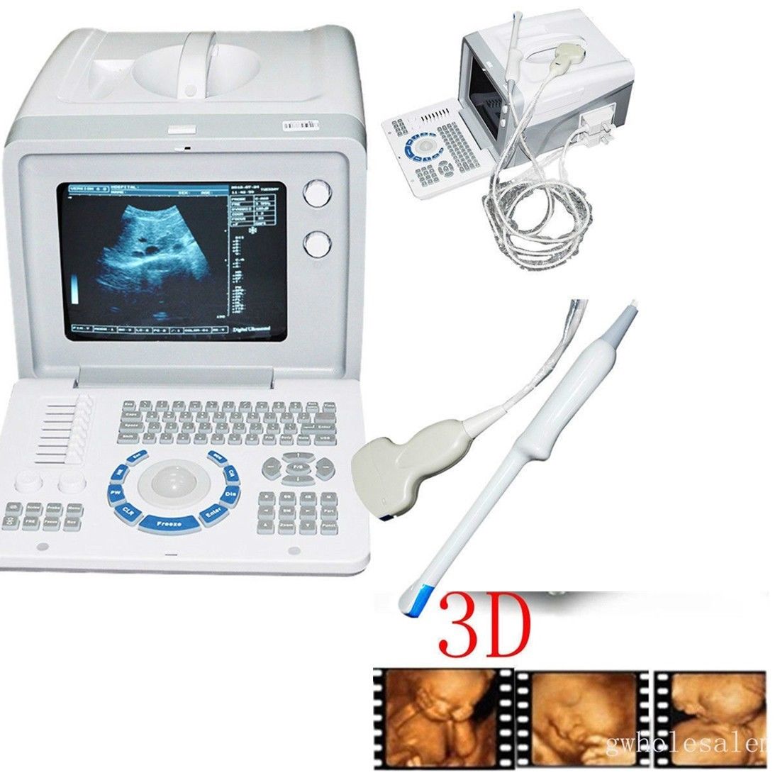 Image 3D Digital Portable Ultrasound Scanner Machine Convex +Transvaginal Probe 190891982193 DIAGNOSTIC ULTRASOUND MACHINES FOR SALE