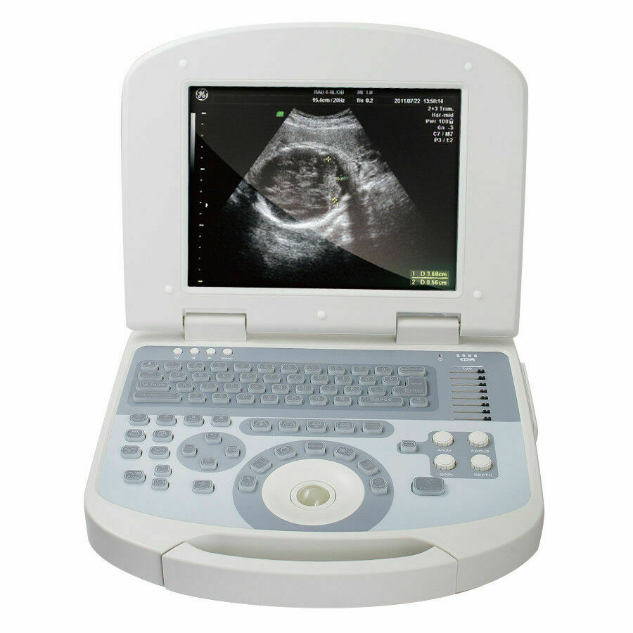 Portable Laptop Diagnostic Ultrasound Scanner Machine Convex Transducer+3D Free DIAGNOSTIC ULTRASOUND MACHINES FOR SALE