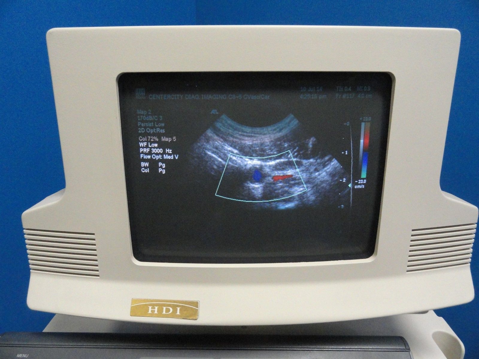 ATL C8-5 14R Micro-Convex Pediatric Small Parts Vascular MSK OB Probe (6865) DIAGNOSTIC ULTRASOUND MACHINES FOR SALE