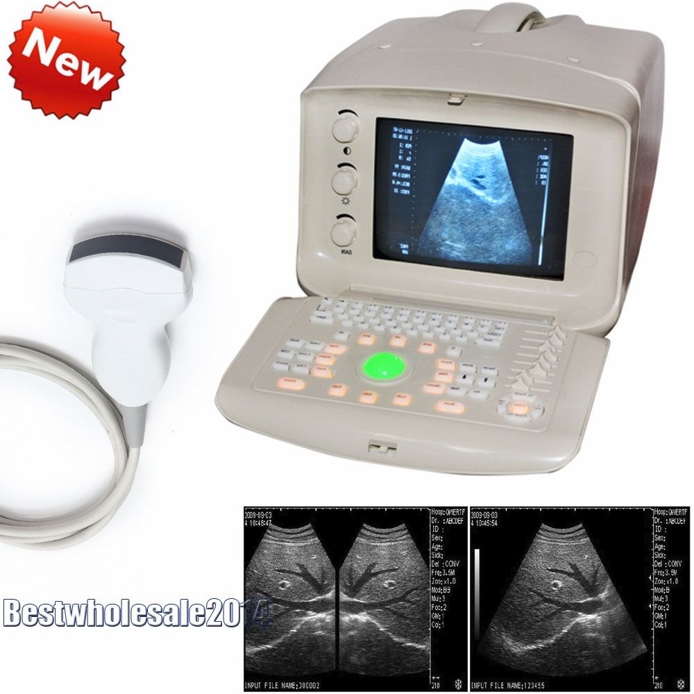 Digital Ultrasound Scanner/Machine 3.5Mhz Convex Transducer/Probe 3D A+ DIAGNOSTIC ULTRASOUND MACHINES FOR SALE