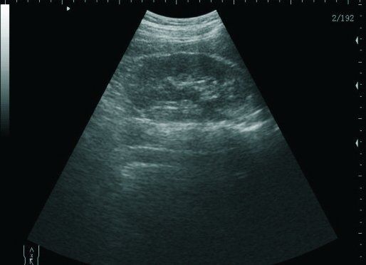 Laptop Ultrasound Scanner Machine 3D Convex Probe Ultrasound for dogs Animal VET 190891767318 DIAGNOSTIC ULTRASOUND MACHINES FOR SALE