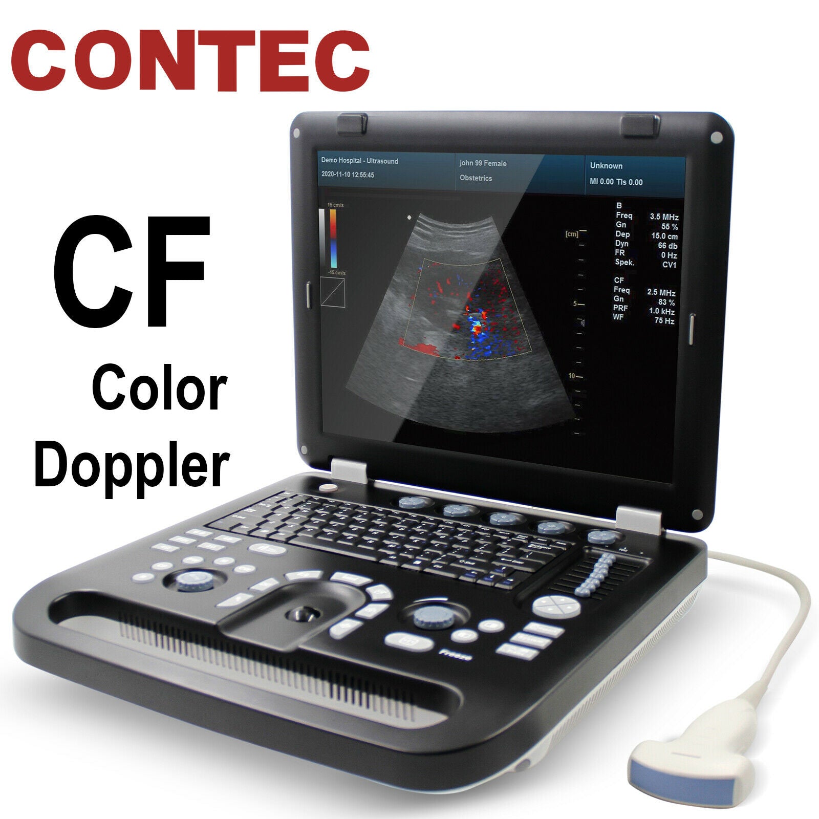 Portable Ultrasound Scanner Color Doppler Machine+ Convex Probe, PW CW,USB+Video DIAGNOSTIC ULTRASOUND MACHINES FOR SALE