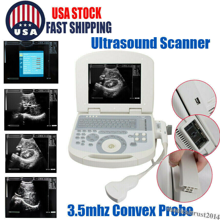 Portable Human Digital Laptop Ultrasound Scanner Machine System Convex Probe 3D DIAGNOSTIC ULTRASOUND MACHINES FOR SALE