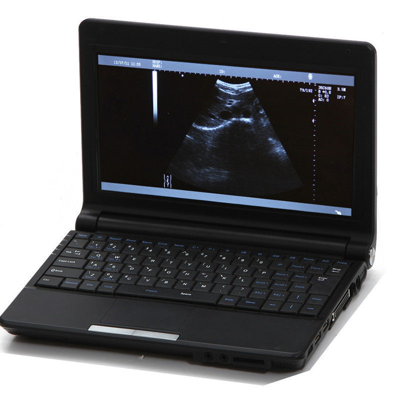 Linear+Transvaginal Probe Portable Laptop Ultrasound Scanner+Free 3D Software CE 190891829528 DIAGNOSTIC ULTRASOUND MACHINES FOR SALE