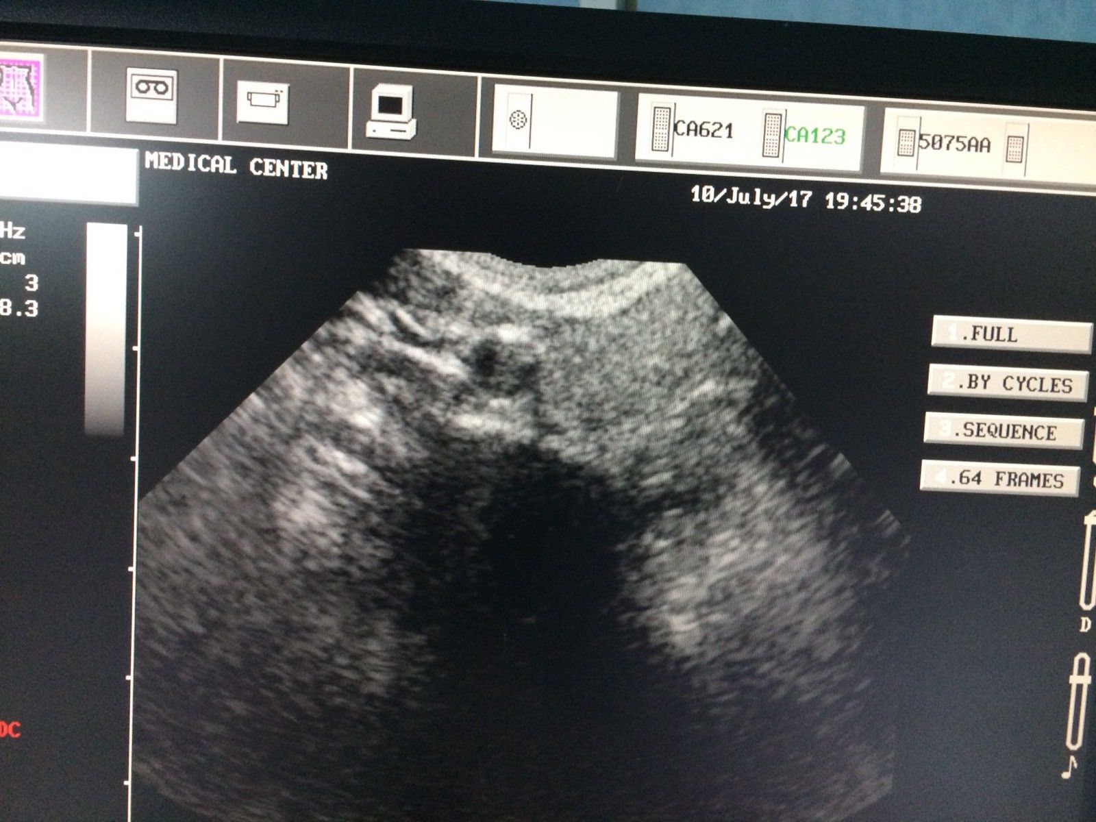 Esaote Biosound, MyLab ultrasound CA123 micro convex probe DIAGNOSTIC ULTRASOUND MACHINES FOR SALE