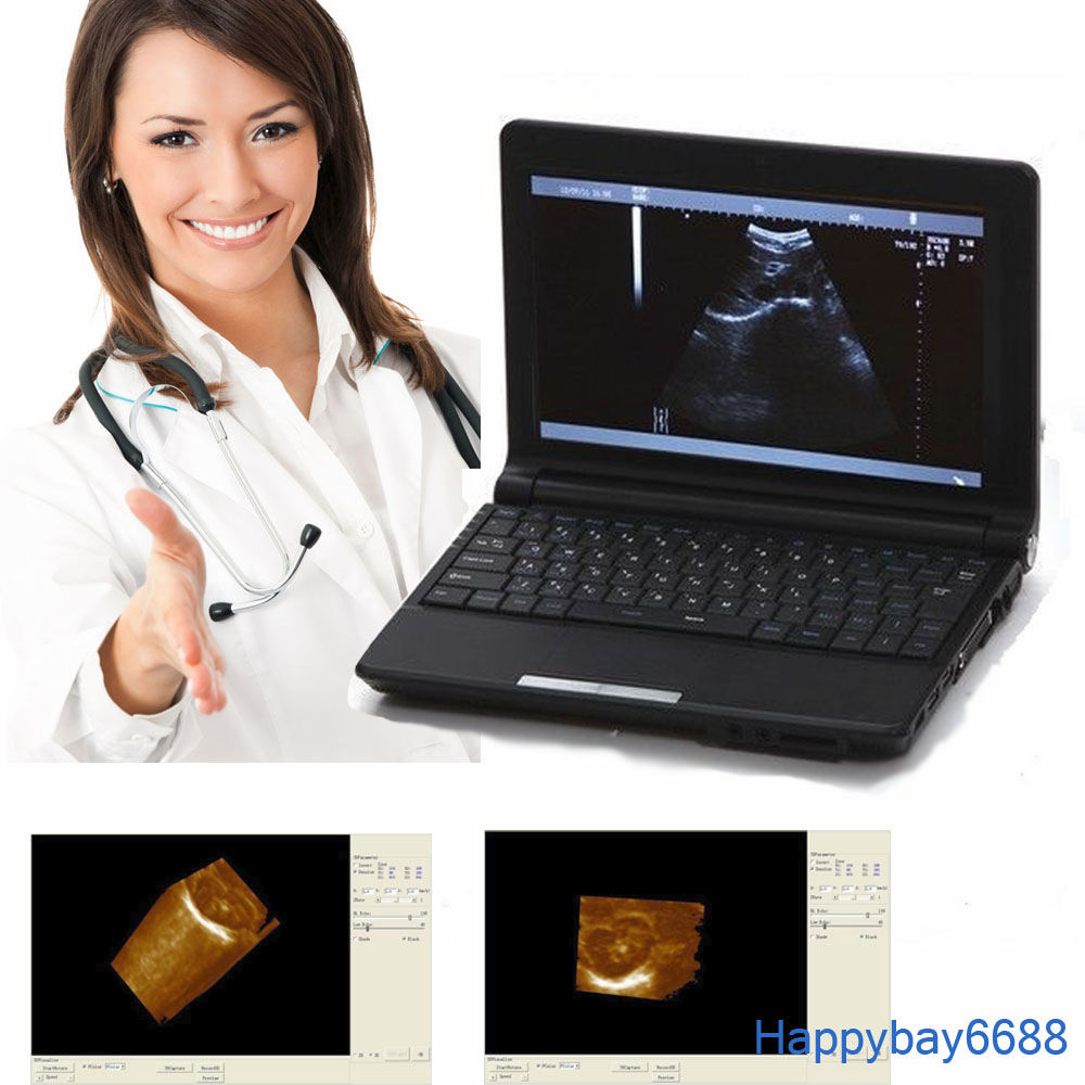 Full Digital Laptop Ultrasound Scanner Probe 6.0mhz Transvaginal Probe 3D Kit 190891462466 DIAGNOSTIC ULTRASOUND MACHINES FOR SALE