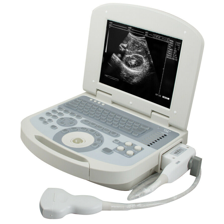 Portable laptop machine Full Digital Ultrasound Ultrasonic scanner Convex probe DIAGNOSTIC ULTRASOUND MACHINES FOR SALE