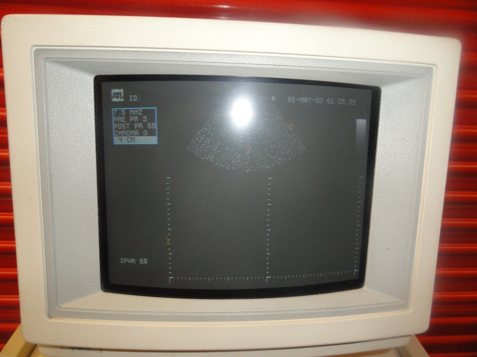 INTERSPEC ATL APOGEE CX ULTRASOUND SYSTEM W/ 7.5 SPA & ACL1547 PROBES (5828 ) DIAGNOSTIC ULTRASOUND MACHINES FOR SALE