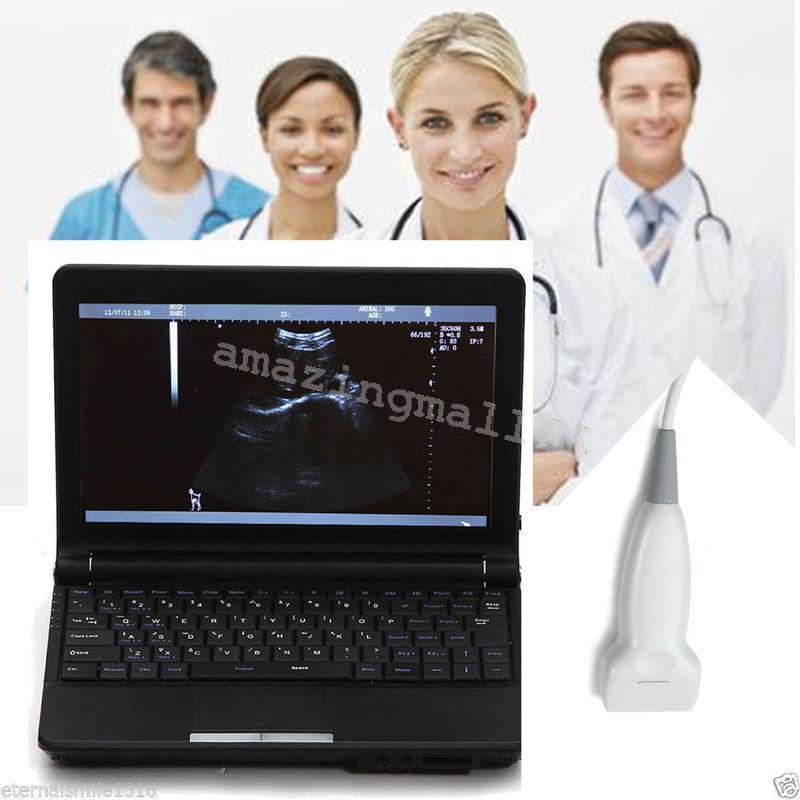 Digital Laptop Machine Ultrasound Scanner + 7.5 Linear Probe/Transducer +3D CE 190891468864 DIAGNOSTIC ULTRASOUND MACHINES FOR SALE