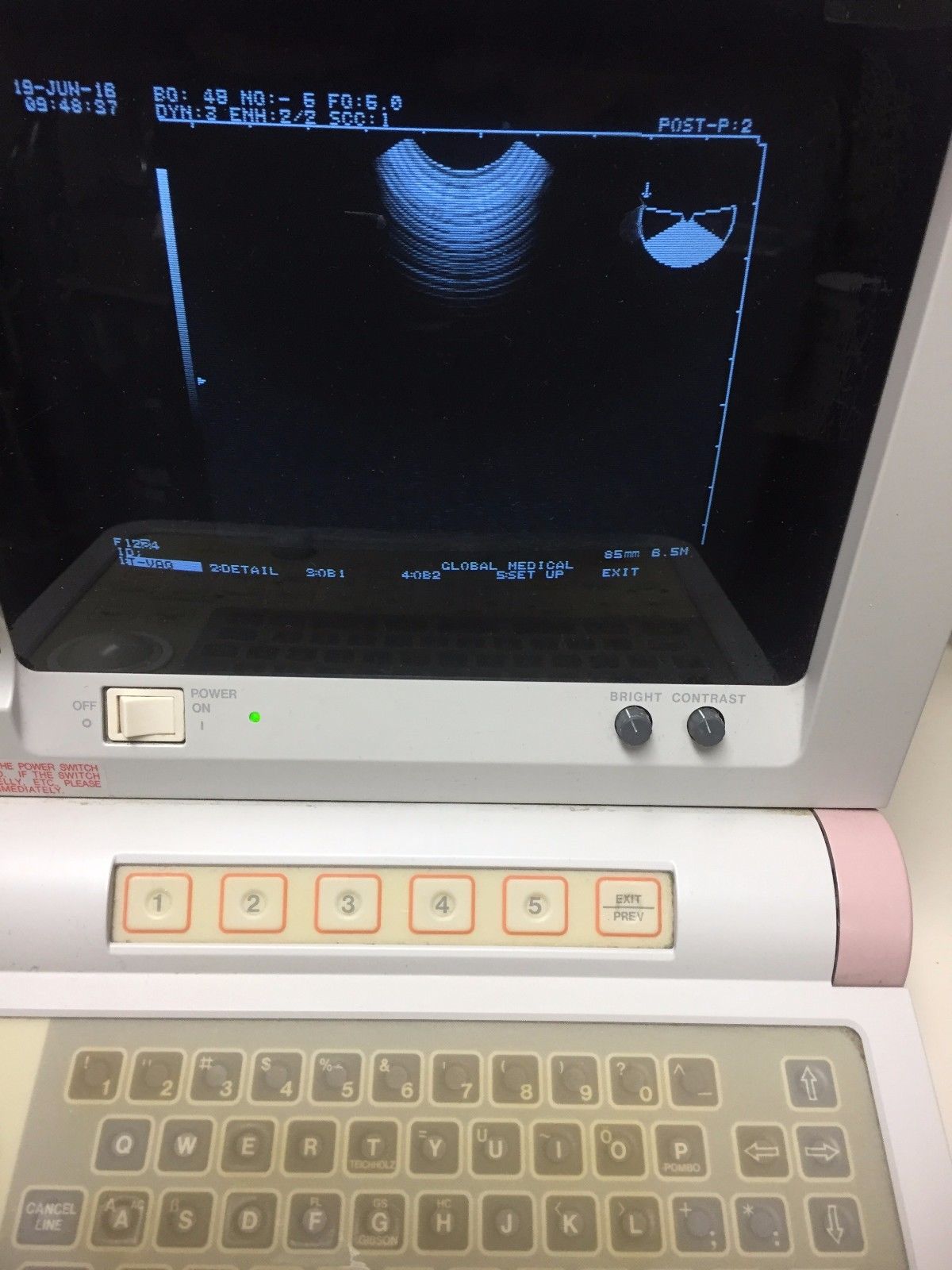 Hitachi EUB-405 Plus Ultrasound / 2 probes / 2 transducer port / printer DIAGNOSTIC ULTRASOUND MACHINES FOR SALE