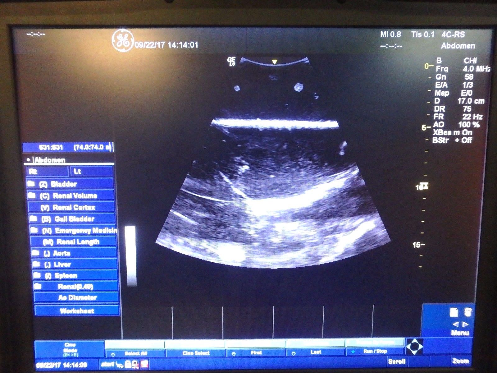 GE LOGIQ-e BT12 Portable 3D Ultrasound w/ 12L-RS Linear & 4C-RS Convex Probes DIAGNOSTIC ULTRASOUND MACHINES FOR SALE