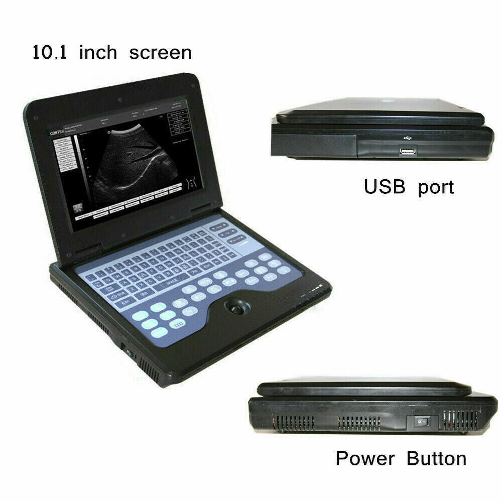 Digital Portable Ultrasound Machine Laptop Scanner with 3.5Mhz Convex Probe CE 6945040100362 DIAGNOSTIC ULTRASOUND MACHINES FOR SALE